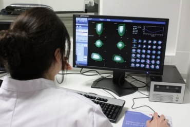 العلاج بالأشعة: علاج اليود